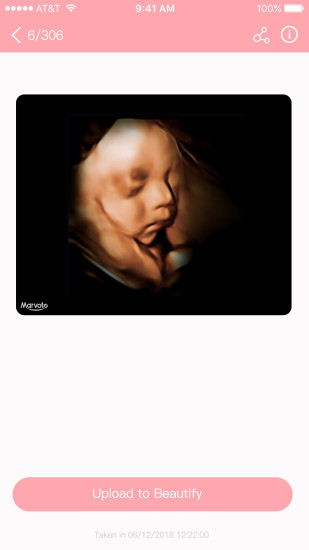 胎儿相机截图