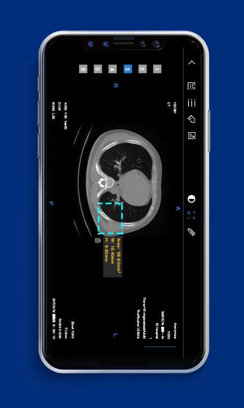 Dicomlabel医疗影像云标注平台App截图